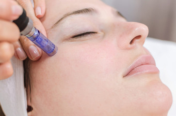 BCL MICRONEEDLING Facial In London at Beauty Case London